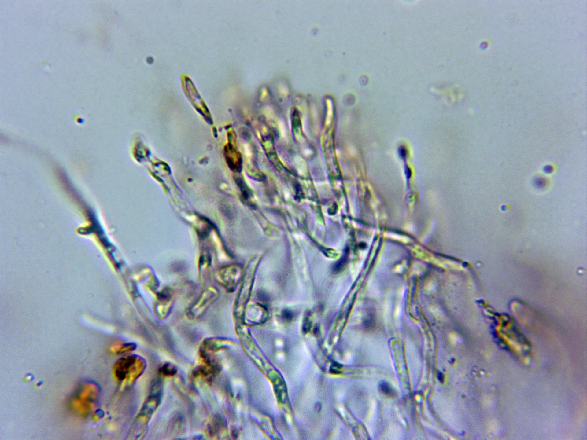 Microscopía de Pseudohydnum gelatinosum - 12 - Cutícula